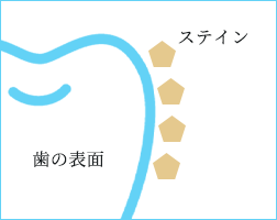黄色いステインが歯の表面にくっついているイメージ図